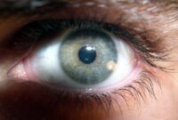 Eye cream