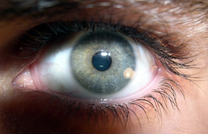 File:Brown human eye (2).jpg - Wikimedia Commons Eye cream