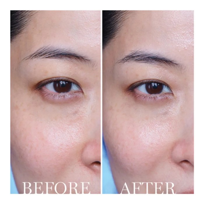 Lancome eye cream